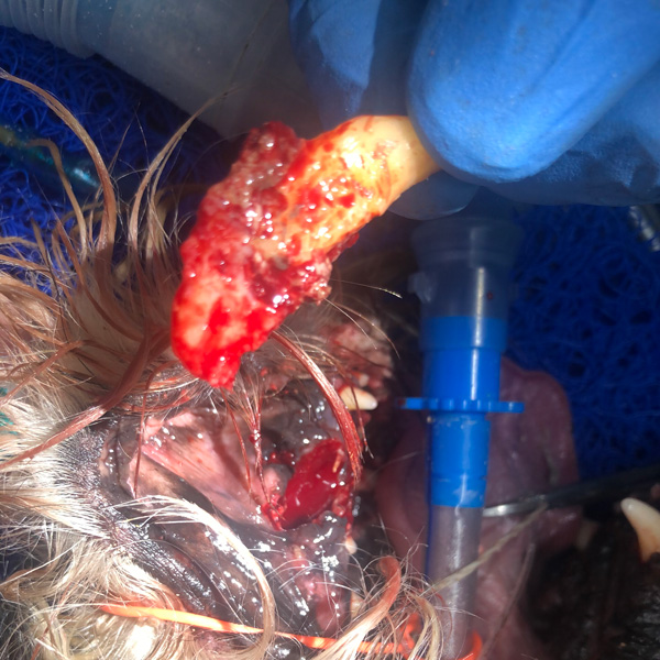 extracted-tooth